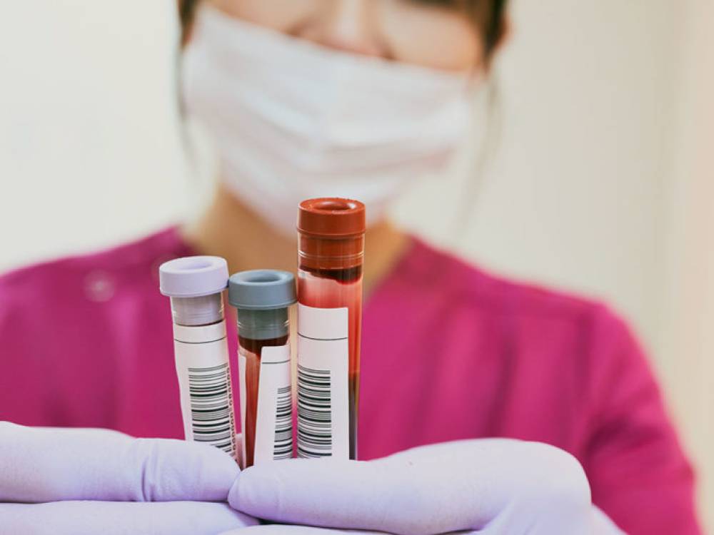 Signs You Need to Get a New Complete Blood Test